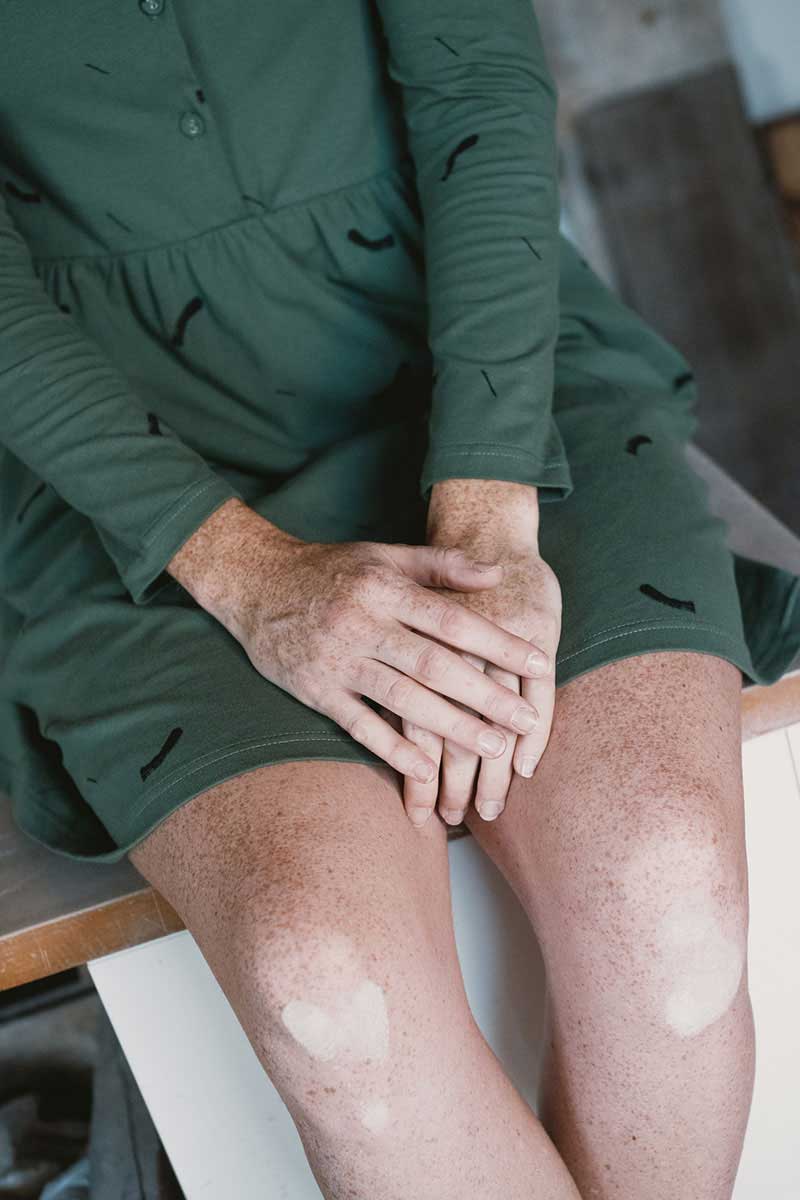 Vestido de manga larga ecológico verde con trazos - Imagen 4